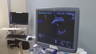 Discussion: Abortion providers suing to stop SB 8 | FOX 7 Austin