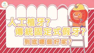 【秒懂牙科】人工植牙？傳統固定式假牙？到底哪個好呢？
