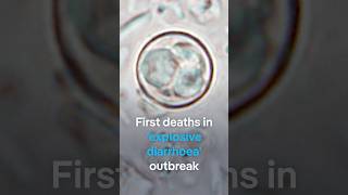 Information US reports first deaths from parasite that causes explosive diarrhea | DW News News