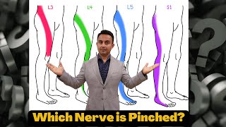 'Which nerve is pinched in my back?'