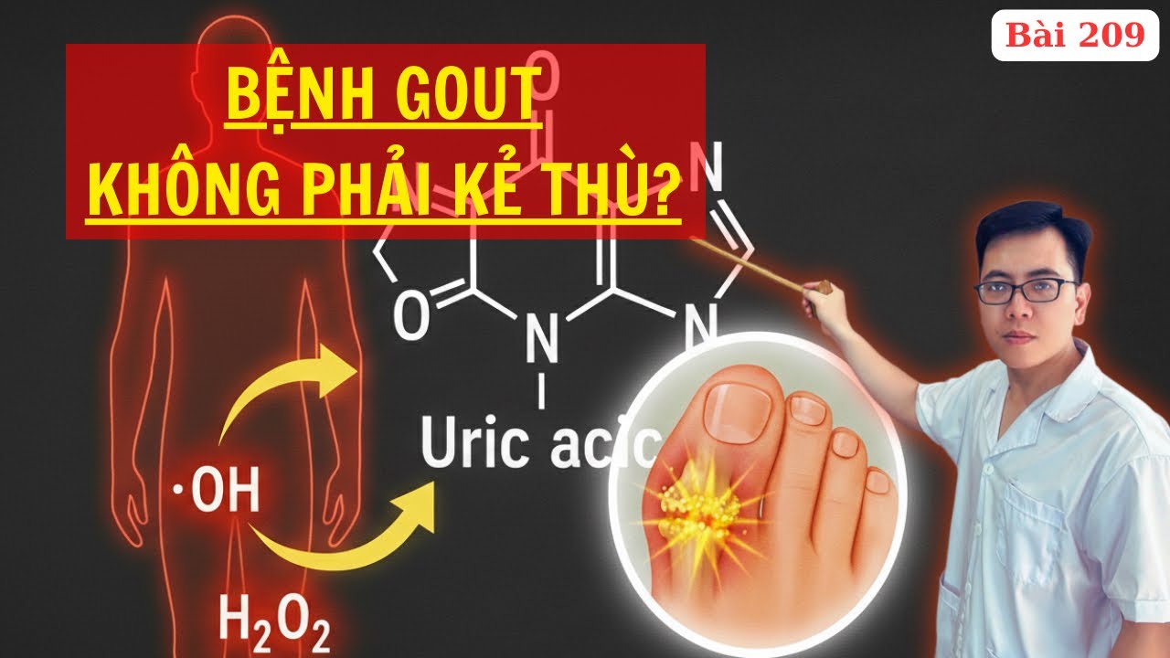 Bệnh GÚT - Hiểu Đúng và Đầy đủ về Acid Uric