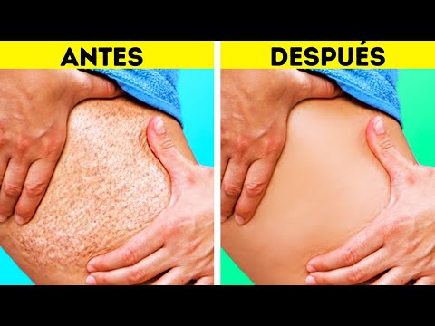 Video: Remedios Naturales Para La Belleza Natural