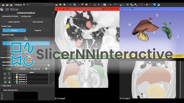 SlicerNNInteractive Demo Video