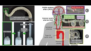 Serially-Connected Soft Continuum Robots for Endovascular Emergencies