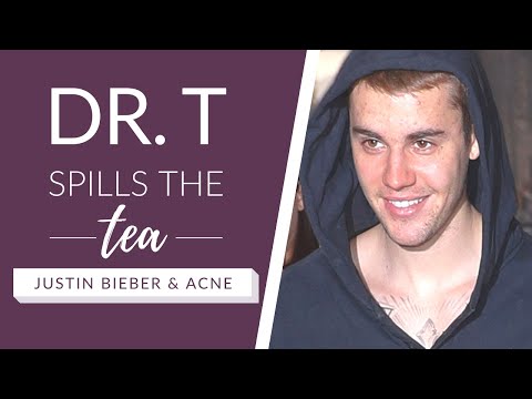 Video: Justin Bieber Can't Get Rid Of Acne