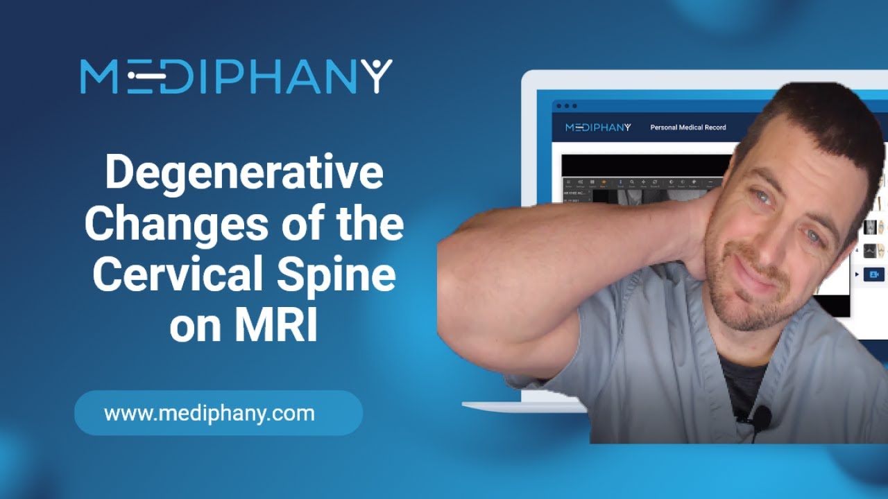 Degenerative Changes of the Cervical Spine on MRI - YouTube