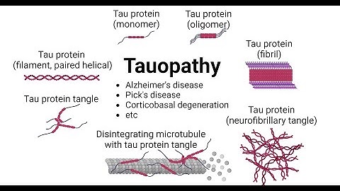 Microglial activation and tau transmission aggravated by Galectin-3 in tauopathy