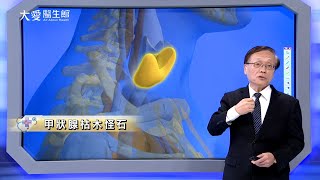 【大愛醫生館】甲狀腺枯木怪石 20240327