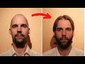 Guy Filmed Cool Timelapse of Growing Hair