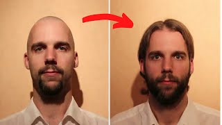 Guy Filmed Cool Timelapse of Growing Hair