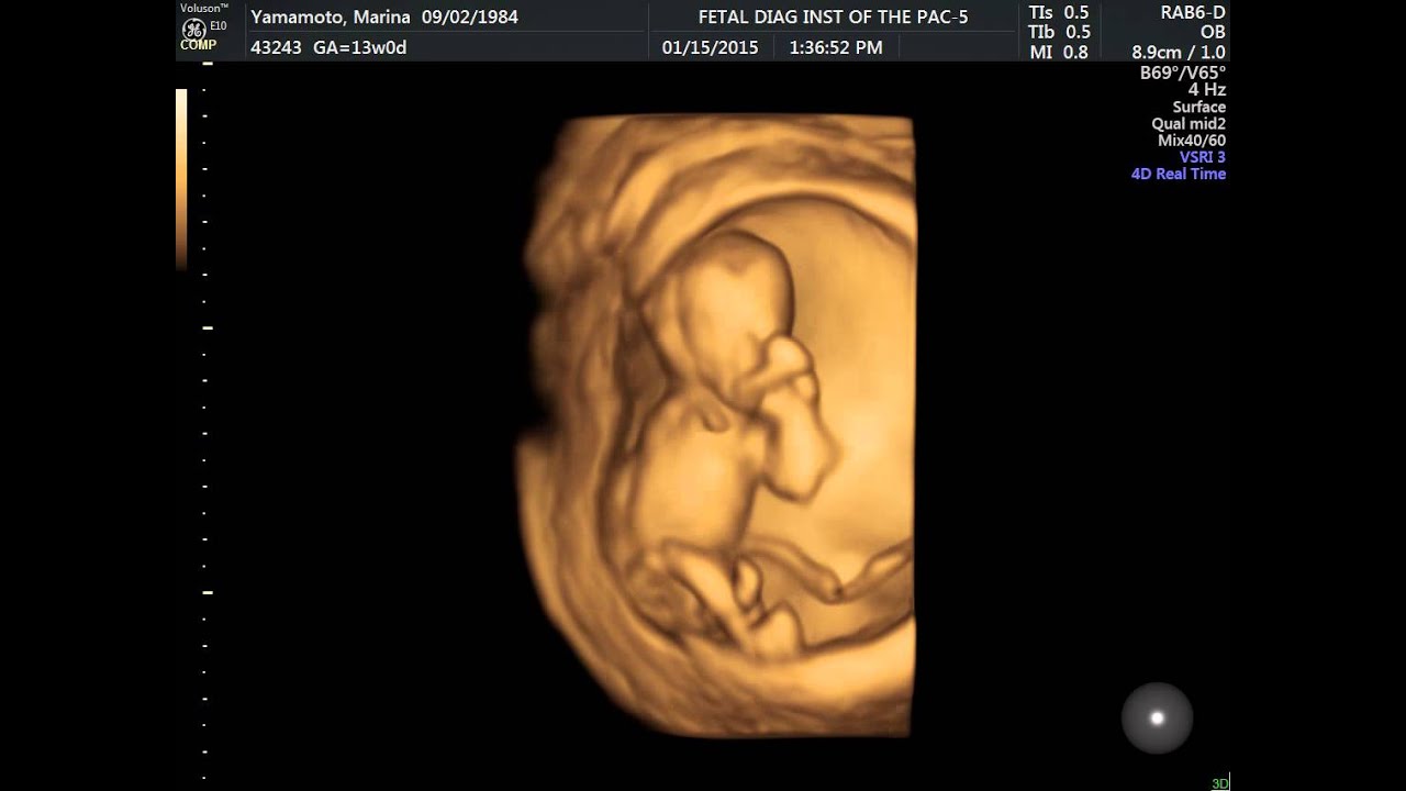 13-week-4d-ultrasound-youtube