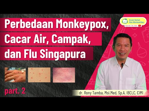 Perbedaan Monkeypox, Cacar Air, Campak, dan Flu Singapura - dr. Rony Tamba, Sp.