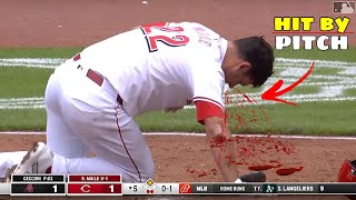 MLB•| Worst Hit-By-Pitch 2nd Week May 2024