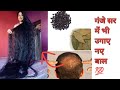 Hair growth toner for new hairs growth mrdvlogsuttrakhand