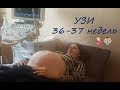Vlog/Едем на УЗИ/ 37недель беременности