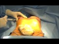 breast augmentation/ breast implant surgery.  Live plastic surgery video.