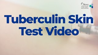 Tuberculin Skin Test Video - 2022