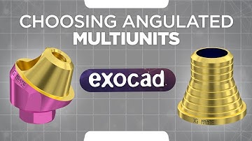 Exocad tutorial | Choosing angulated multi units | How to work with ExoCad library