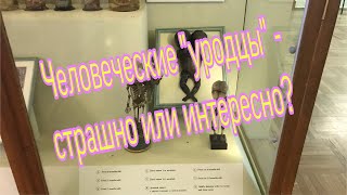 #Уродцы  из #Кунсткамеры  и их история
