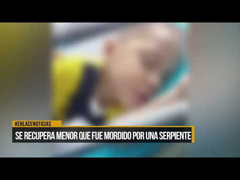 Menor de 3 años fue mordido por una serpiente en Puerto Wilches