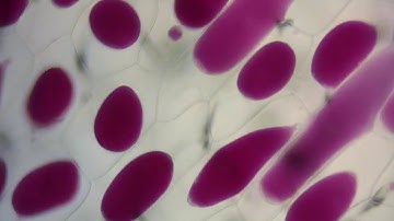 Red onion cell plasmolysis and its reversal