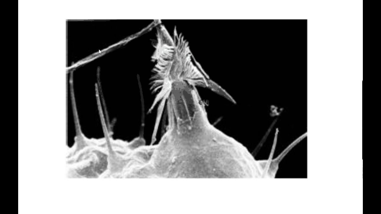 6.2 Sponges, Cnidarians and Flatworms YouTube