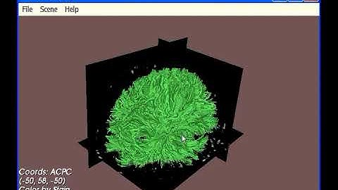 tensor field Stanford