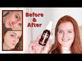 Youth to the People Vitamin C + Caffeine Serum | Honest Review + Before & After Pics
