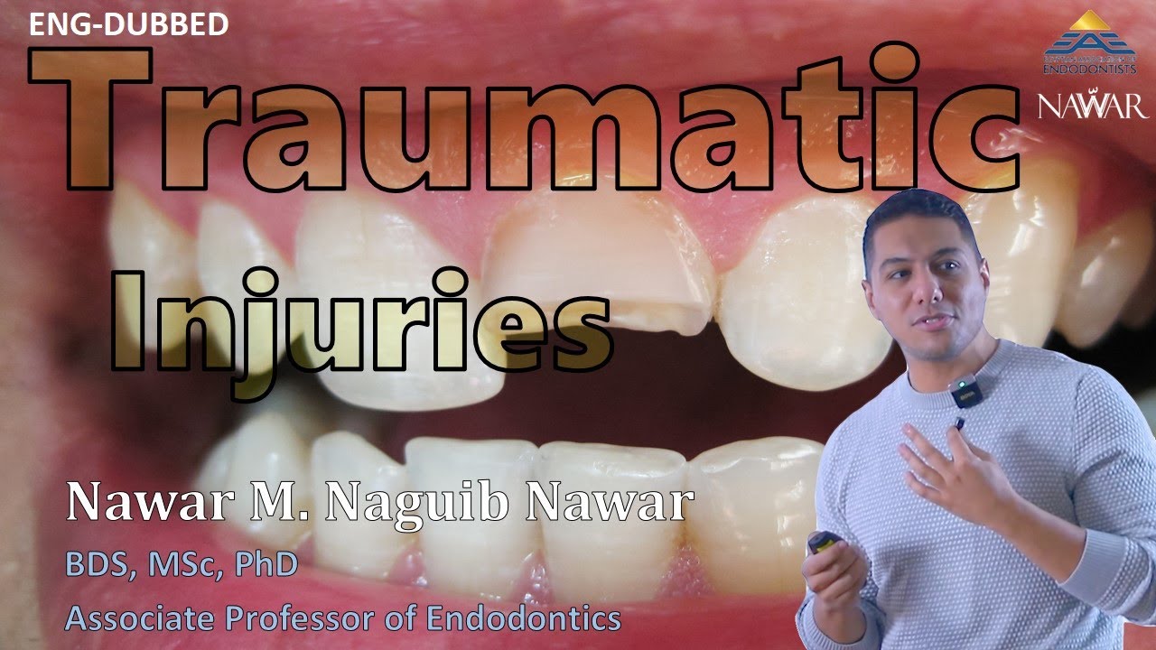 Traumatic Dental Injuries: Lecture 1 - English-dubbed - YouTube