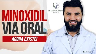 MINOXIDIL ORAL: Tomar Minoxidil é melhor do que passar ? | Dr Lucas Fustinoni