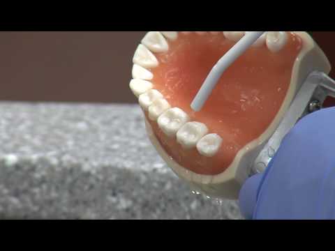 New cavity treatment offers no drilling, no filling