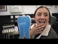 Invisalign &amp; Composite Bonding Results Revealed - Dentist Preston &amp; Blackburn