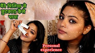 ऐसी Skin problem जिसको ठीक करना बहुत मुश्किल है| मिलिया का सबसे अच्छा treatment घर पर ही | ABHIKSHA