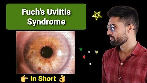 Fuchs heterochromic iridocyclitis lecture