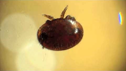 Varroa under microscope Edit 1.m4v