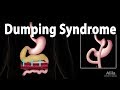 Dumping Syndrome, Animation