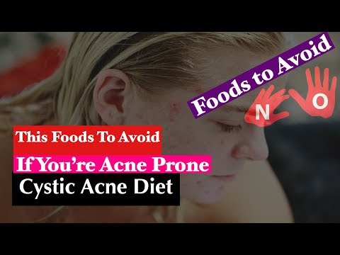 Foods to Avoid for Cystic Acne || Cystic Acne Diet || Young Age Infection ||  #