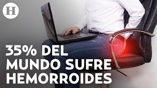 Hemorroides: Por qué salen y cuál es su relación con la mala alimentación; así puedes prevenirlas