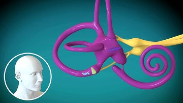 MUSC: Benign Paroxysmal Positional Vertigo (BPPV)