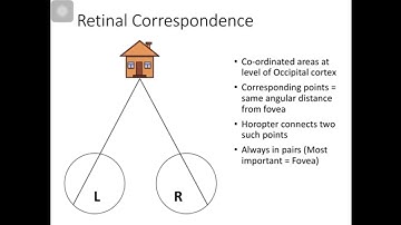 Diplopia v/s Confusion