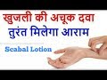 पूराने से पुराने खूंजली को करे गायब || Scabal Lotion &amp; Alcit Tablets || फुल  वीडियो देखे