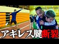 ジュンが撮影中にアキレス腱を断裂しました。