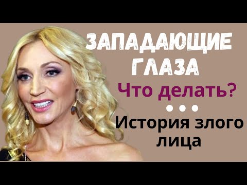 Западающие глаза/Напряженное лицо/Высокомерное выражение лица/Как исправить, смотрите в конце.