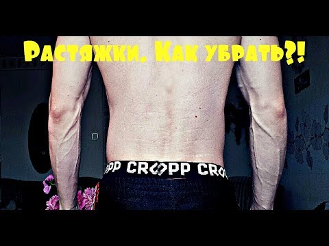 Видео: Растяжки на спине: причины, симптомы и лечение