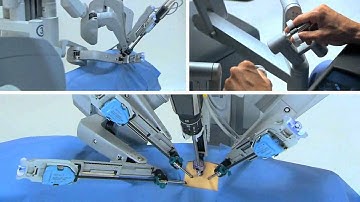 Advantages of robotic surgery