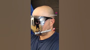 2nd session of Scalp Micropigmentation #scalpmicropigmentation #smp #smptoronto #smp