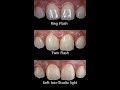 How different light sources affect photography in dentistry