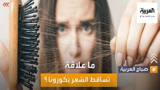 بعد الإصابة بكورونا.. تساقط الشعر بات أحد الأعراض الشائعة