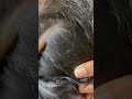 #fypviralシ #statisfying #lice #hair #LiceOnHead #liceremoval  #brasil #xyzbcafyp #licecomb  #kutu