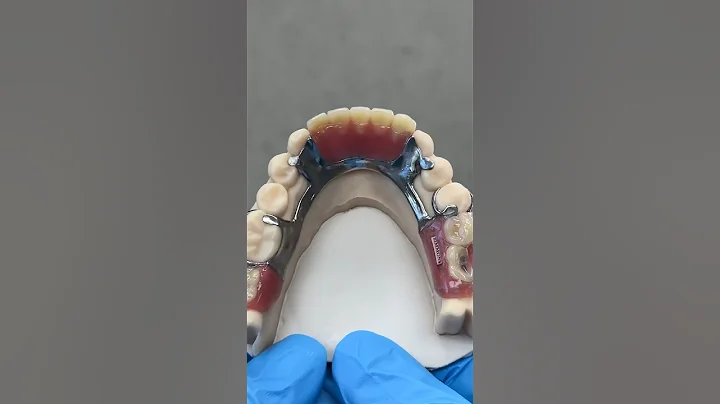 Titanium Partial @EnvisiontecMain #envisiontec #dental #teeth #smile #lsk121shorts #shortvideo